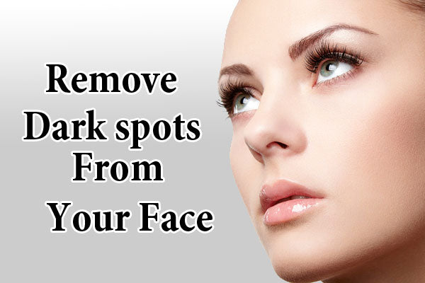 Natural Methods To Remove Dark Spots From Your Face