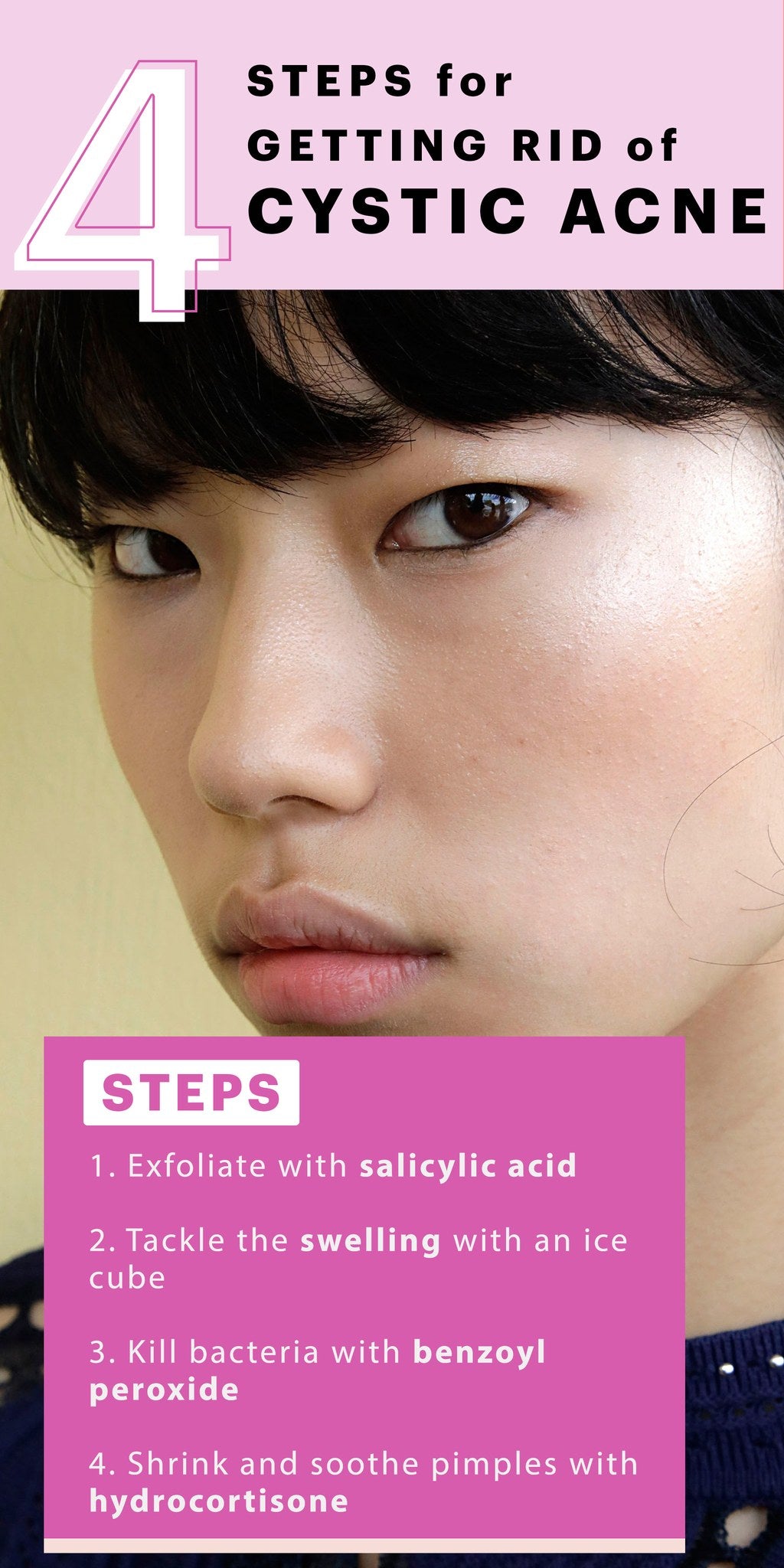 4 Steps to Getting Rid of a Cystic Pimple, Fast