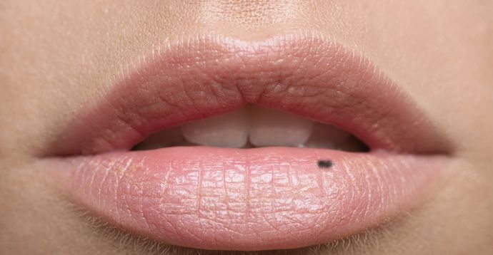 How To Remove Dark Spots On Lips – 5 Tips