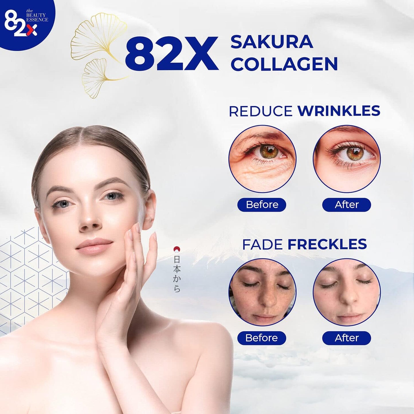 82X Collagen cổ điển