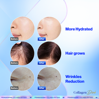 Thực Phẩm Bảo Vệ Sức Khoẻ Koharu Collagen 